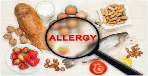 allergies